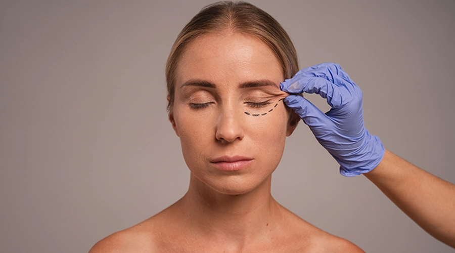 Eyelid Surgery