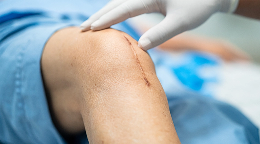 Wound and Tissue Repair